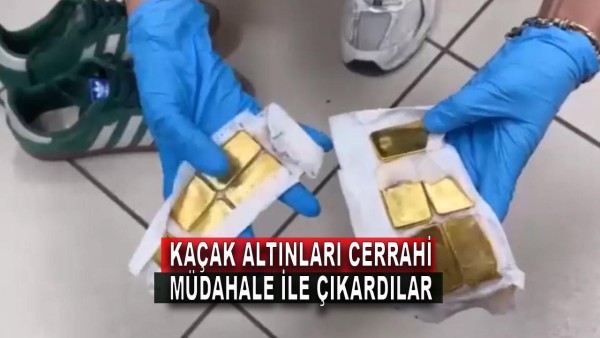 Kaçak Altınları Cerrahi Müdahale İle Çıkardılar